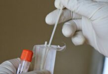 Test Covid-19: il Codacons plaude al blitz dei NAS nei laboratori di analisi in Sicilia Test Covid Codacons